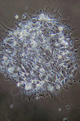 Microscopic view of a colony of original human embryonic stem cell lines from the James Thomson lab at the University of Wisconsin–Madison